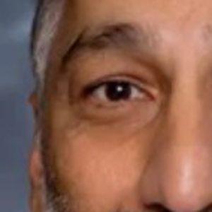 Kambiz Dardashti, MD, FACS