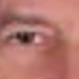 Anthony Demaria, MD