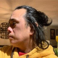 Allan Fernandez, MD