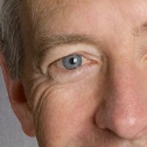 Dennis Selkoe, MD