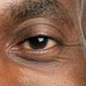 Godwin Darko, MD, MPH