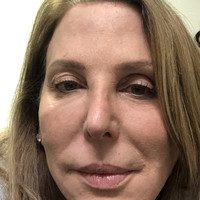 Ann Kasten, MD