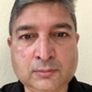Tariq Irfan, MD
