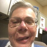 Ervin Eaker, MD