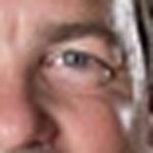 K. Epley, MD