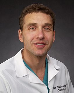 Peter Baciewicz, FACC, MD
