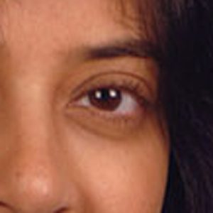 Deepali Mathur, FACOG, MD