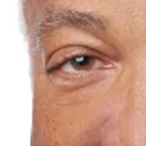 Reginald Sanders, FASRS, MD